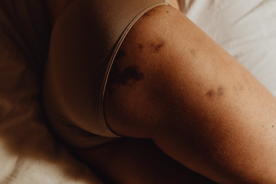 Intimate close-up of a woman's bruised skin, showing body positivity and natural beauty.